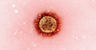 Photo EHEC-Infections